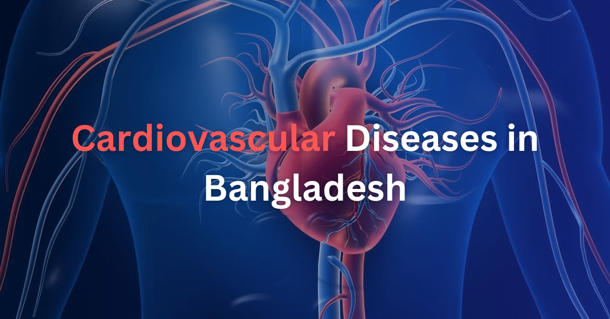 Cardiovascular Diseases in Bangladesh