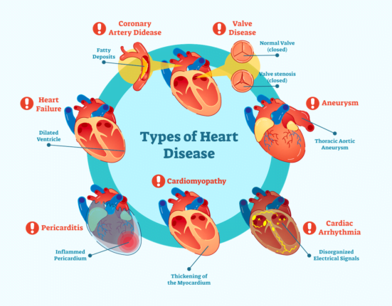 Common-Heart-Diseases-in-Bangladesh