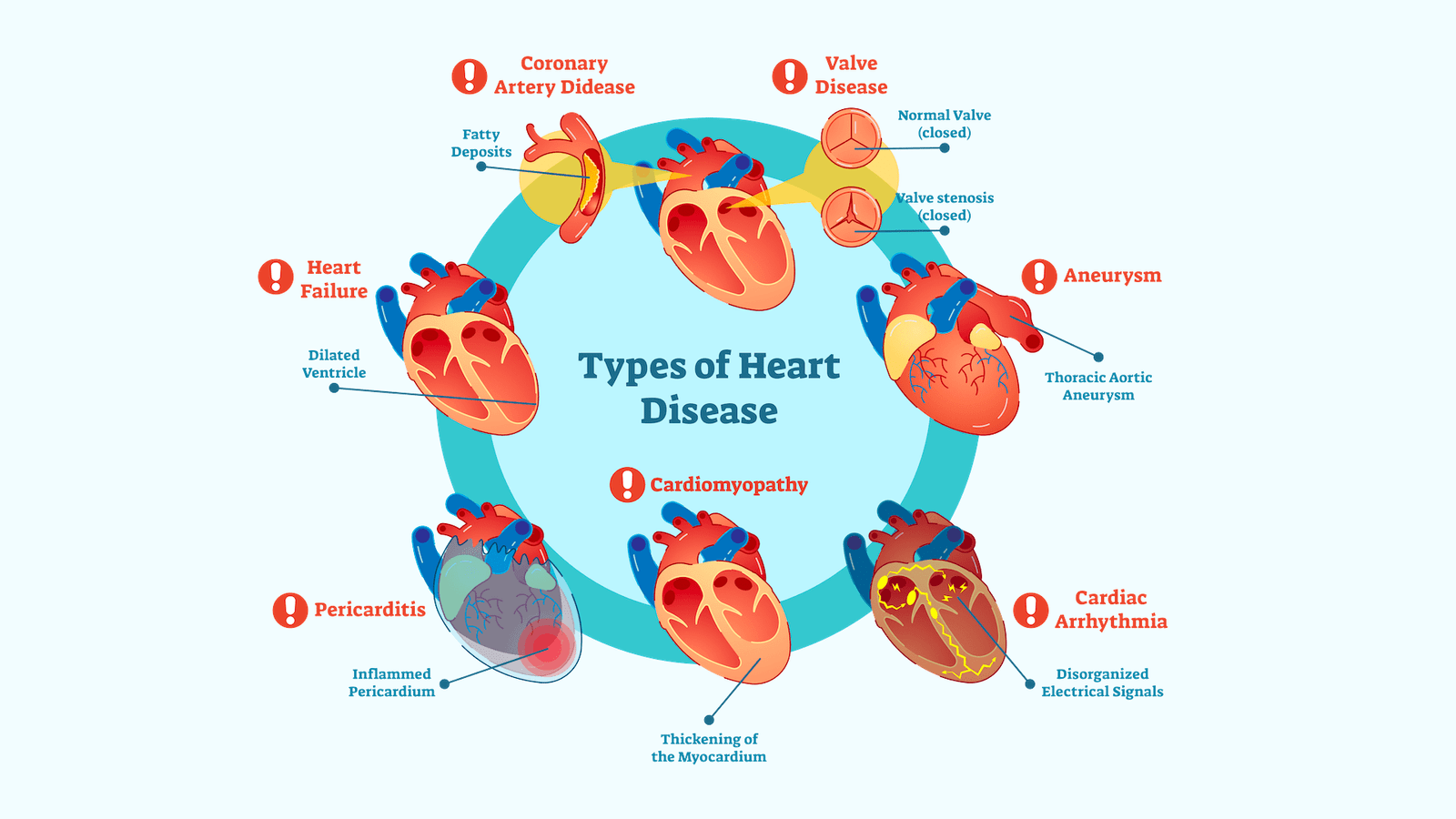 Common-Heart-Diseases-in-Bangladesh