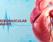 Risk Reduction of Cardiovascular Disease