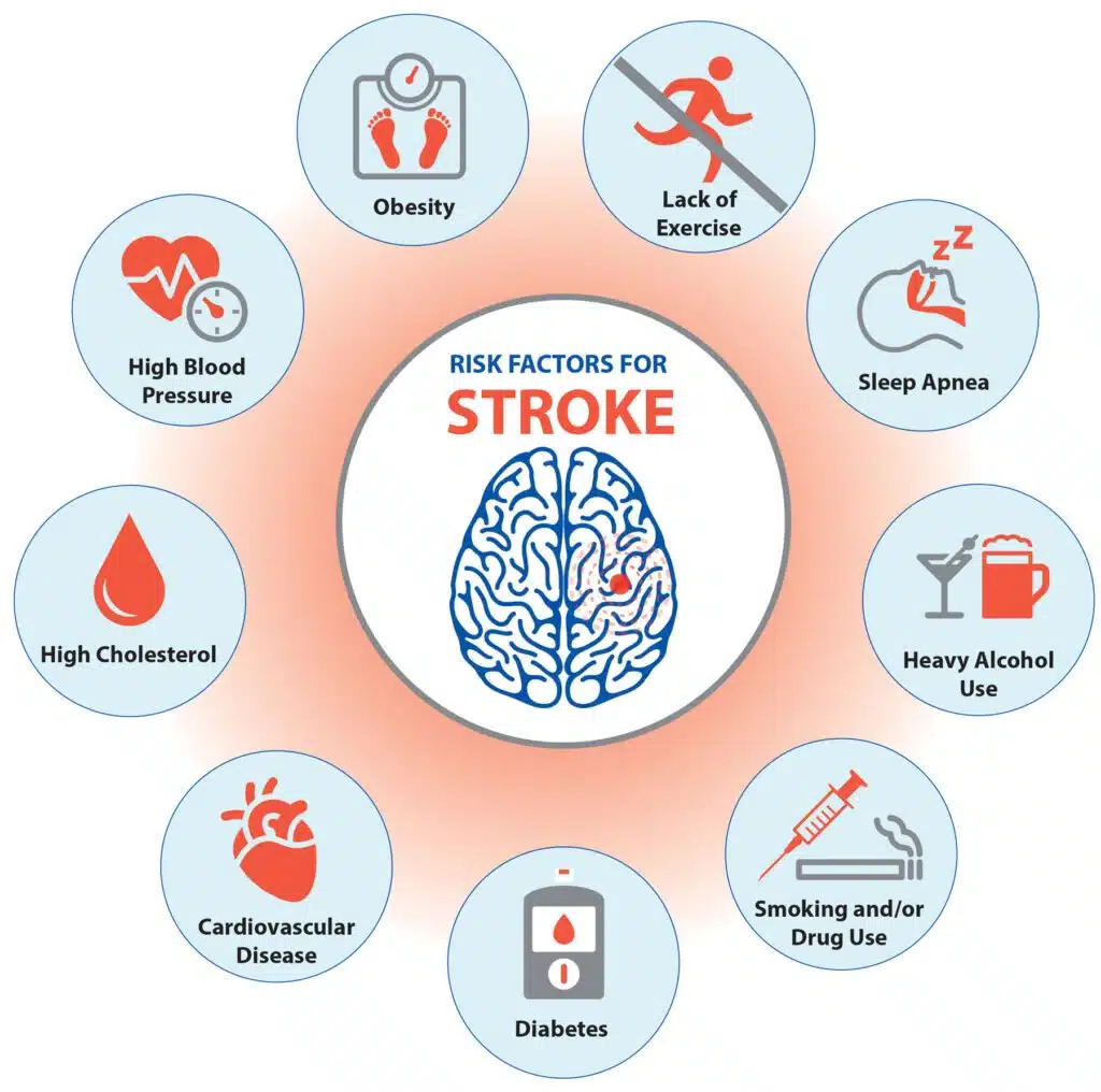 Understanding Heart Diseases and Strokes: Causes, Symptoms, and ...