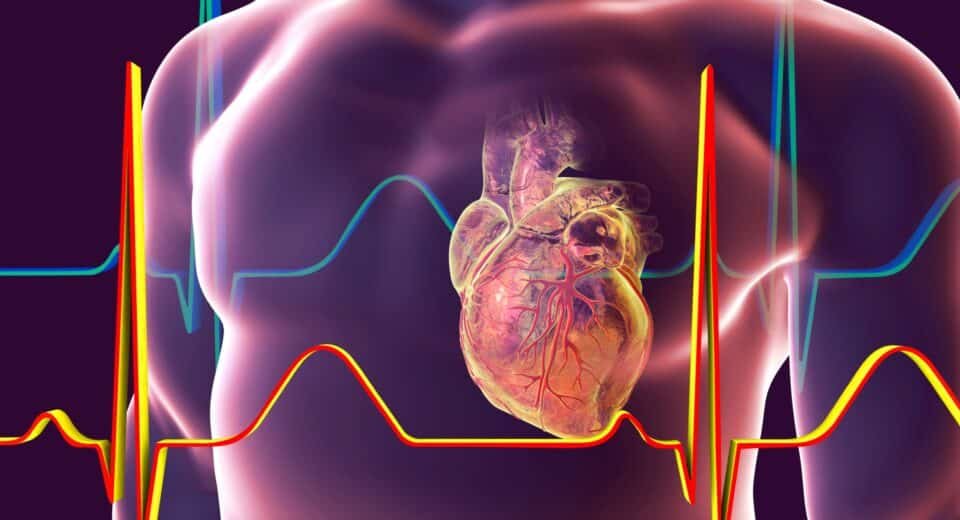 Diagnosis and Treatment of Cardiovascular Diseases in Bangladesh ...