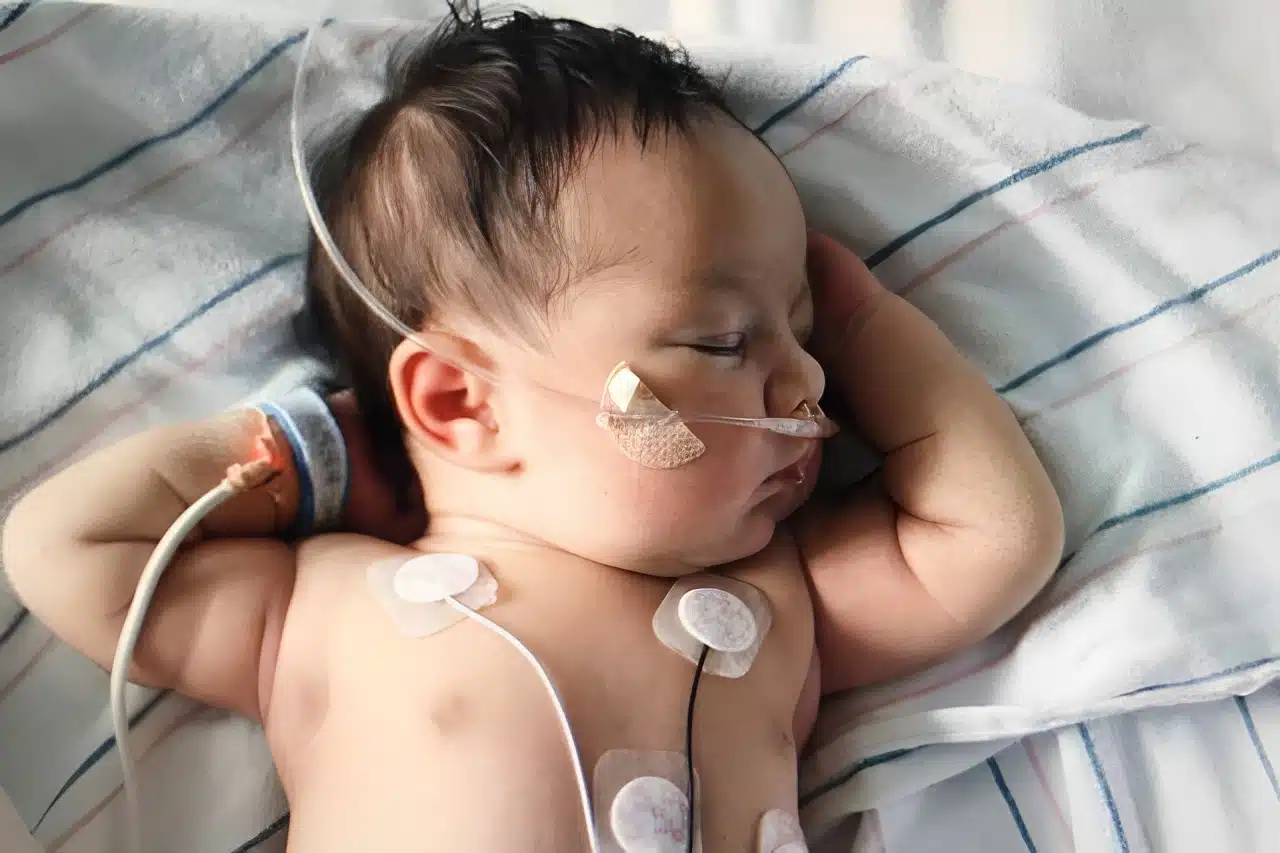 Congenital heart disease of the newborn
