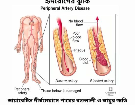 পেরিফেরাল আর্টারি ডিজিজ (PAD)